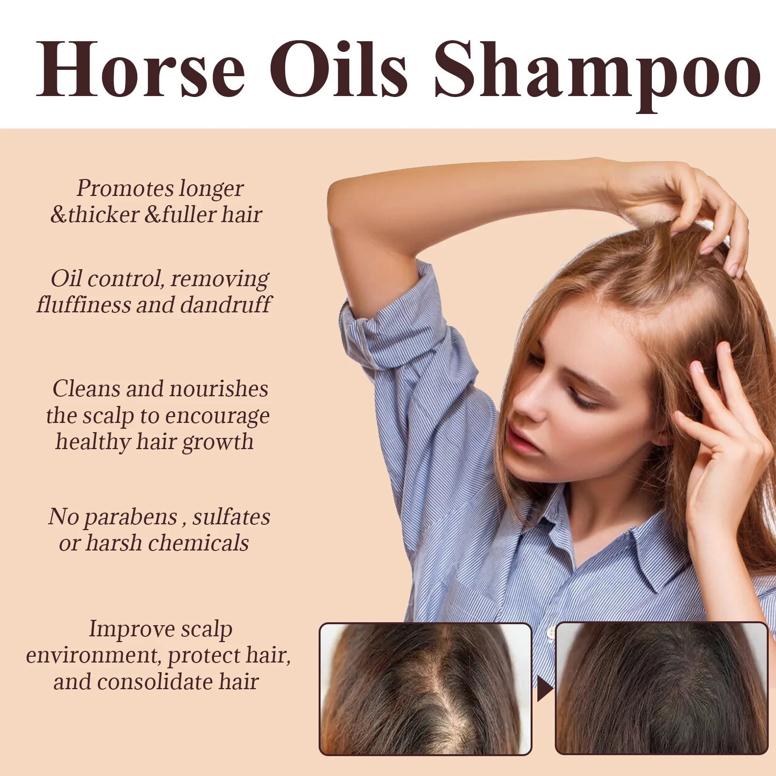 Hair Loss Treatment Fast Hair Growth Hair anti Thinning Repair Scalp Strengthen Hair Roots Deep Cleansing Thickening Hair Care