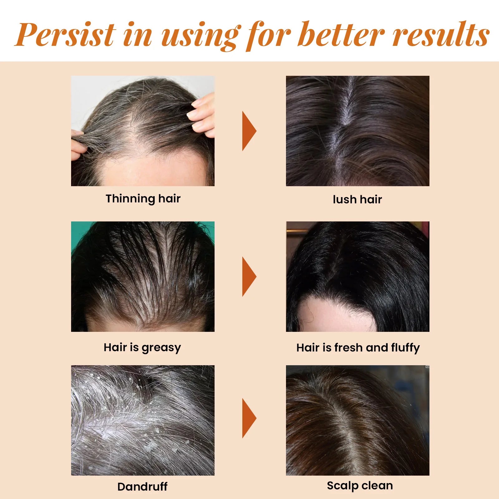 Hair Loss Treatment Fast Hair Growth Hair anti Thinning Repair Scalp Strengthen Hair Roots Deep Cleansing Thickening Hair Care