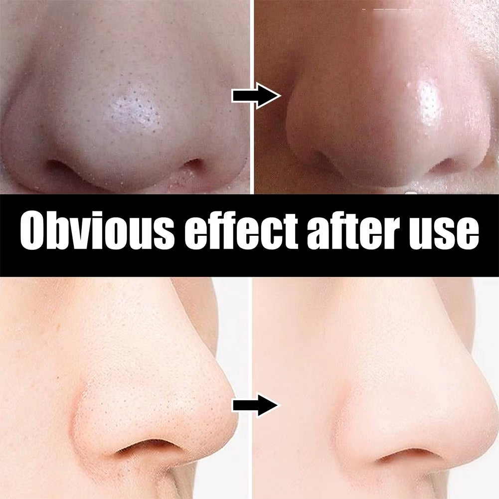 10Pcs Blackhead Remove Mask Nasal Strips Shrink Cleansing Pore Nose Black Head Remove Stickers Skin Care Mask Patch Unisex