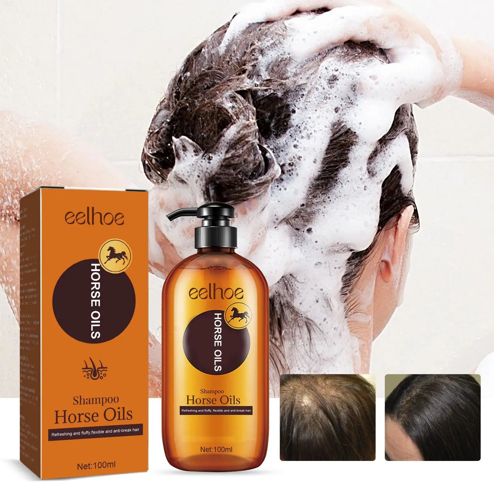 Hair Loss Treatment Fast Hair Growth Hair anti Thinning Repair Scalp Strengthen Hair Roots Deep Cleansing Thickening Hair Care