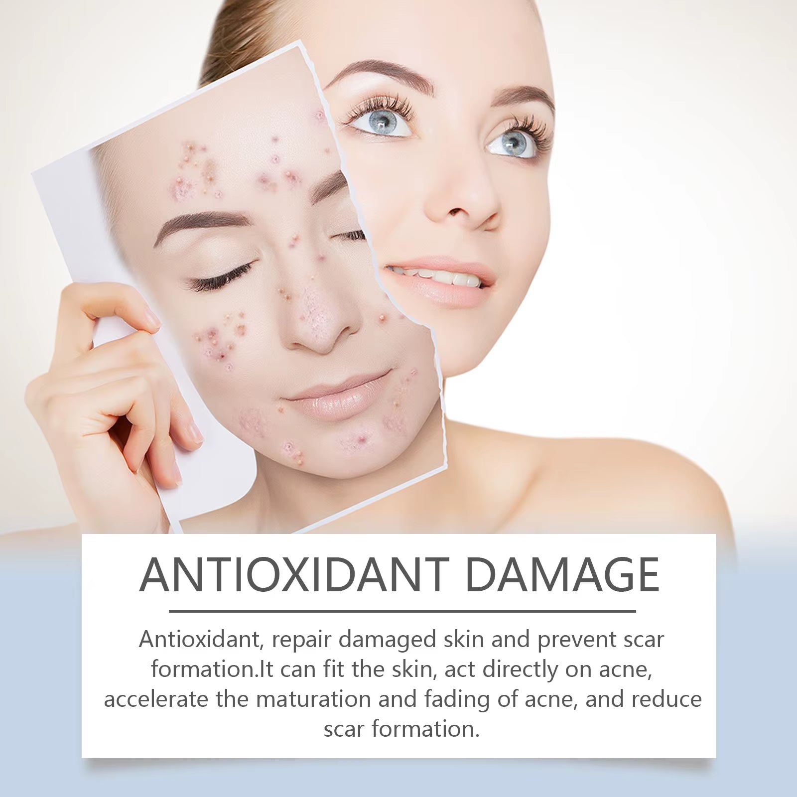 Invisible Acne Patches Removal Pimple Fade Acne Skin Care Stickers Concealer Face Spots Marks Waterproof Beauty Makeup Stickers