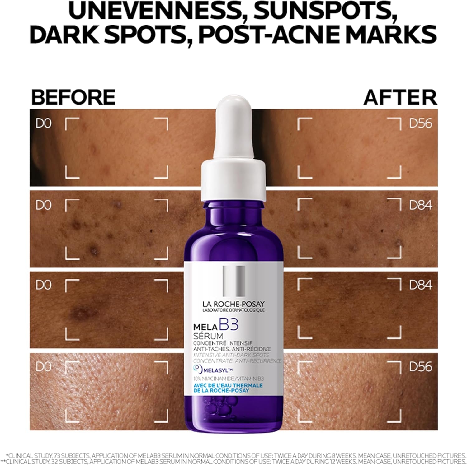 La Roche-Posay Mela B3 Dark Spot Niacinamide Serum 30Ml, with 10% Niacinamide + Melasyl