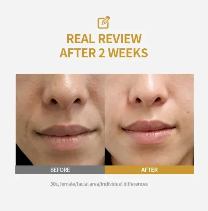 Kojic Acid & Turmeric Facial Serum 30ml – Hydrating Skincare with Niacinamide for a More Even-Looking Complexion