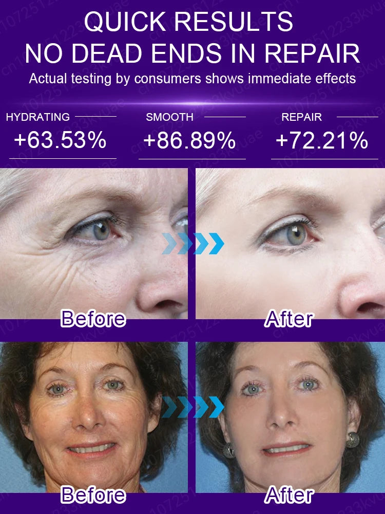 Anti-Aging Facial Serum – Hydrating Skincare for Smoother, More Youthful-Looking Skin