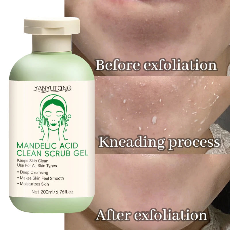 Facial Exfoliating Gel 200ml – Deep Cleansing, Blackhead Care, Oil Control & Smoothing Facial Scrub
