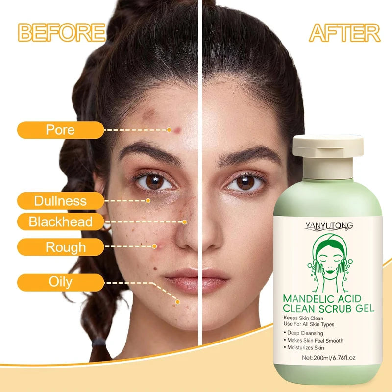 Facial Exfoliating Gel 200ml – Deep Cleansing, Blackhead Care, Oil Control & Smoothing Facial Scrub