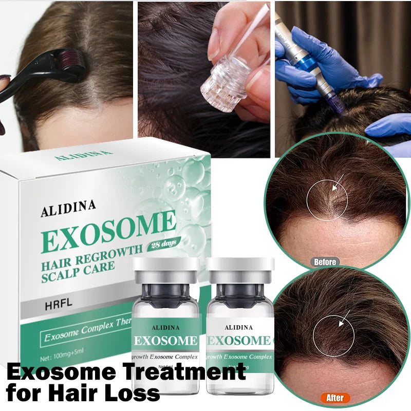 Peptide Scalp Serum Kit 100mg Powder + 5ml Solution – Hair & Scalp Care Treatment