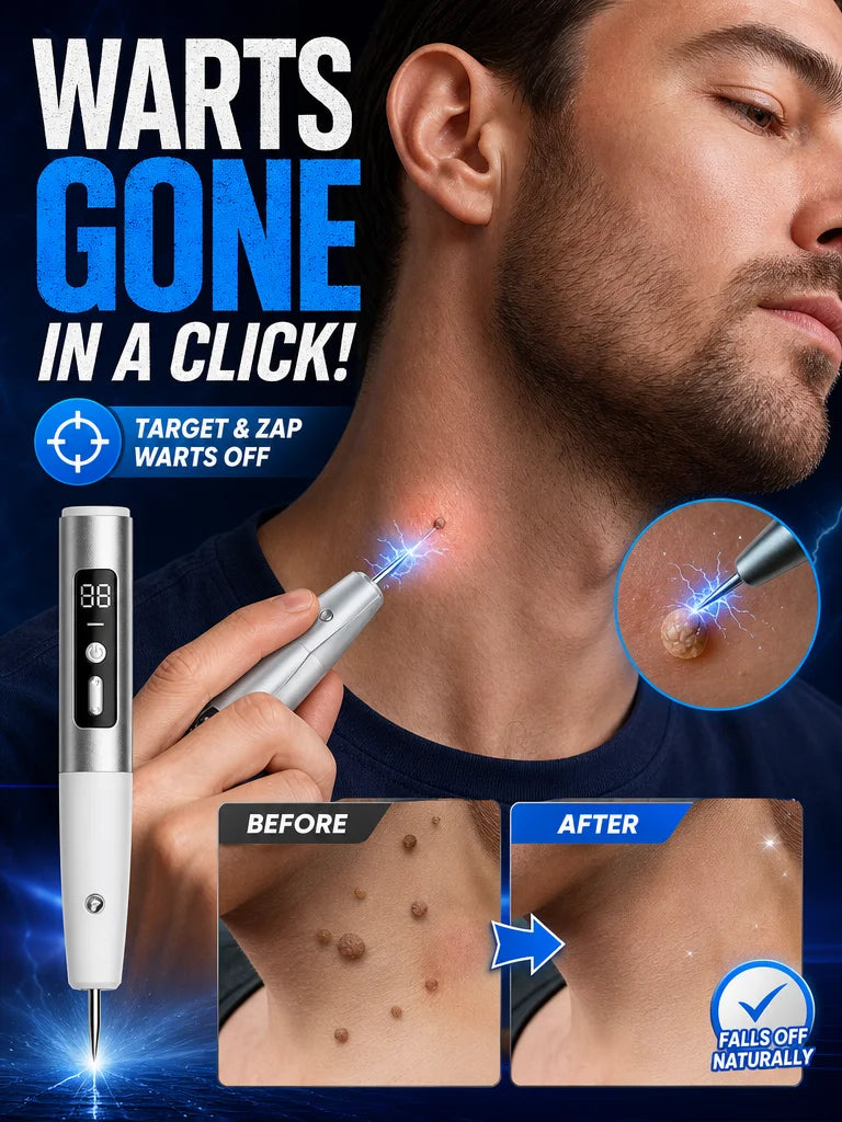 Mole & Skin Tag Removal Pen – USB-Powered Electronic Skin Care Device