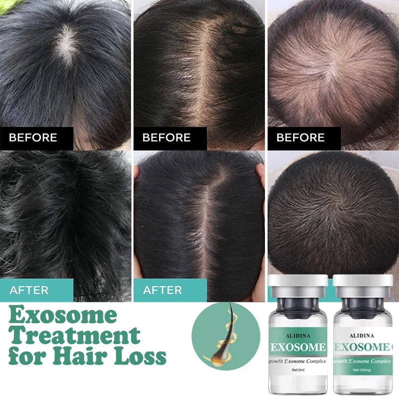 Peptide Scalp Serum Kit 100mg Powder + 5ml Solution – Hair & Scalp Care Treatment