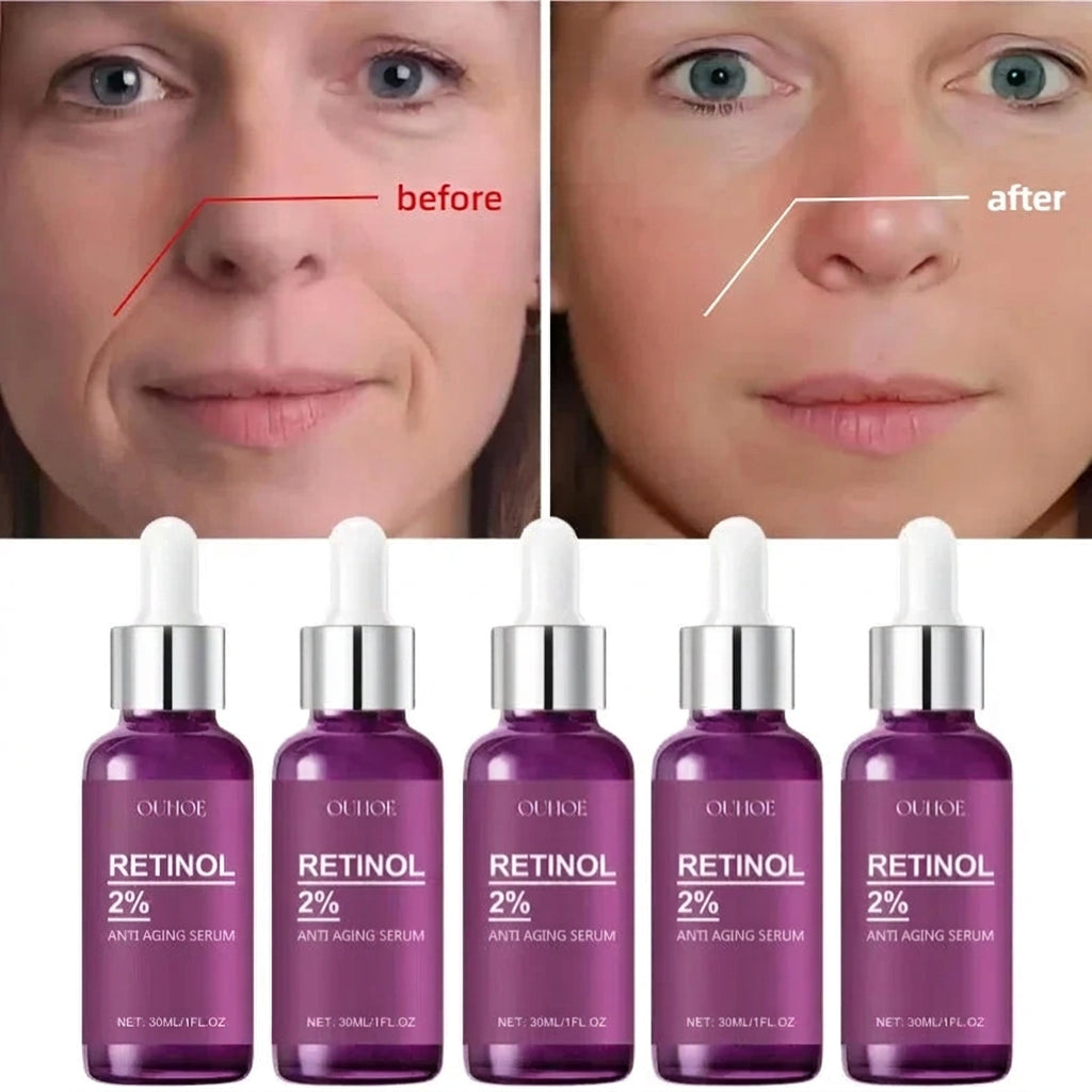 Retinol Facial Serum 30ml – Hydrating Skincare for Smoother, More Even-Looking Skin