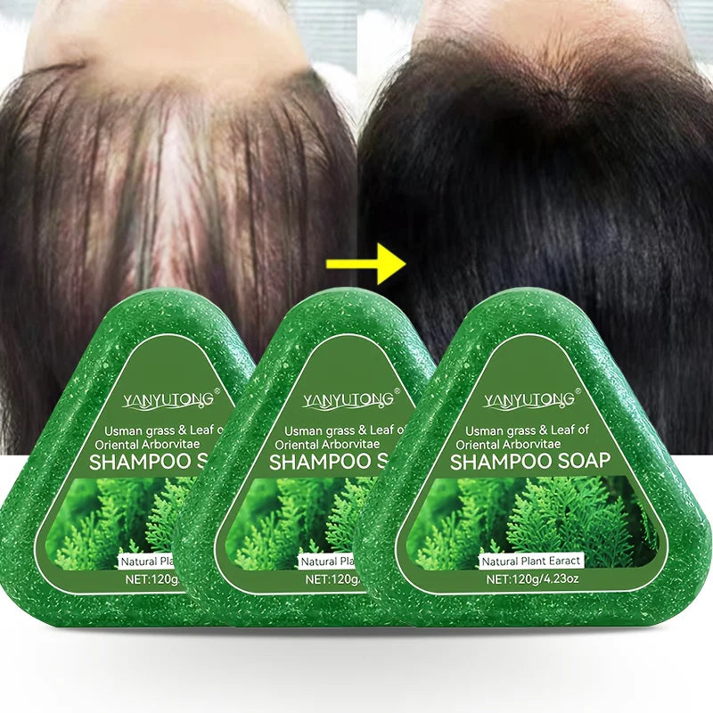 Usman Grass & Platycladus Herbal Shampoo Bar – Natural Shampoo Soap for Healthy Hair & Scalp Care 120g