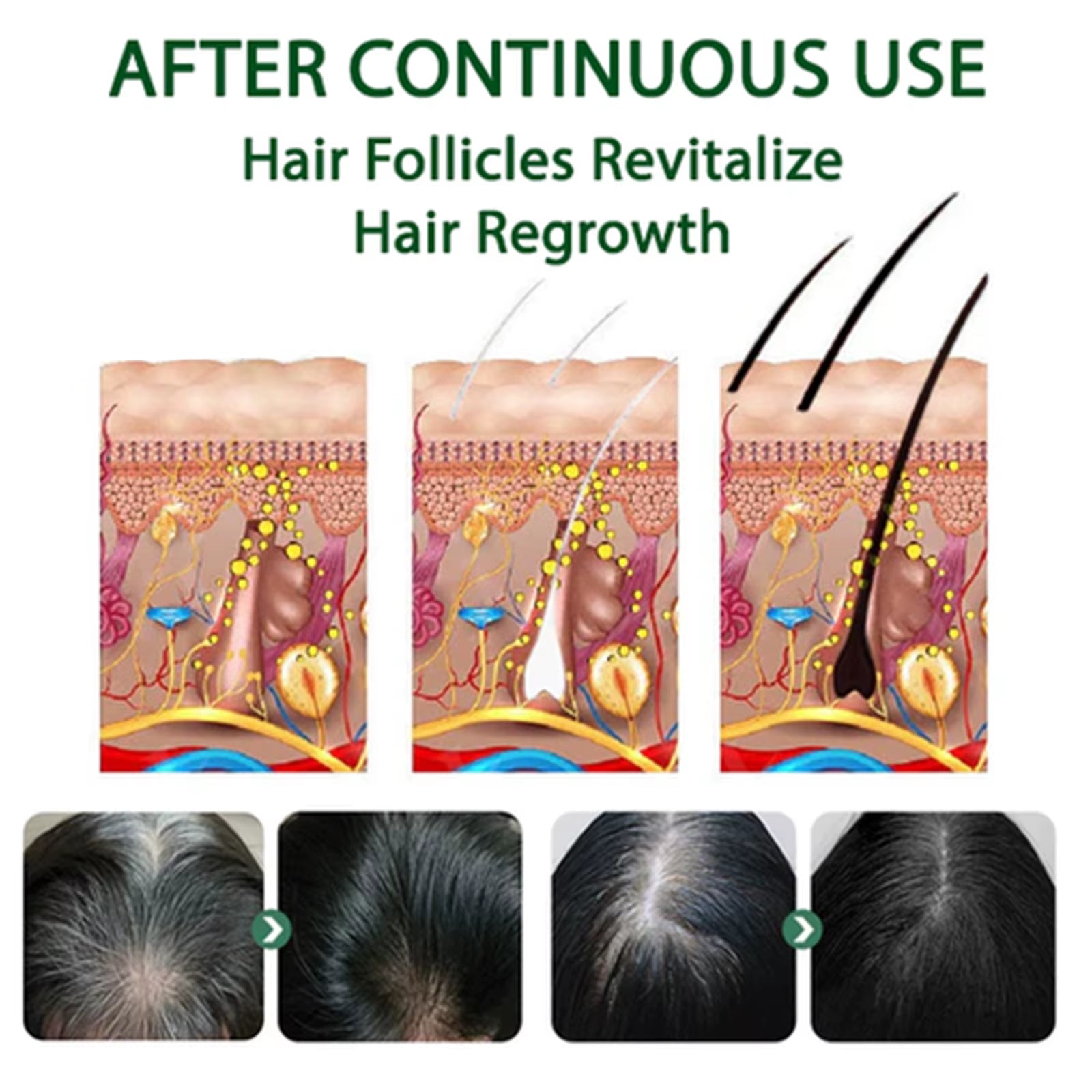 Gray White Hair Treatment Spray White to Black Natural Blackening Reduce Gray Hair Scalp Nourishing Repair Hair Darkening Spray