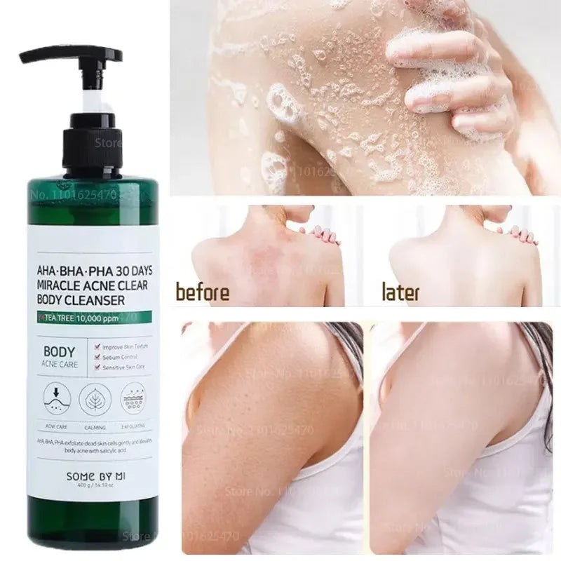 AHA BHA PHA 30 Days Miracle Acne Clear Body Cleanser Skin Soothing Exfoliating Effect Acne Pore Care Purifying Korean Skin Care
