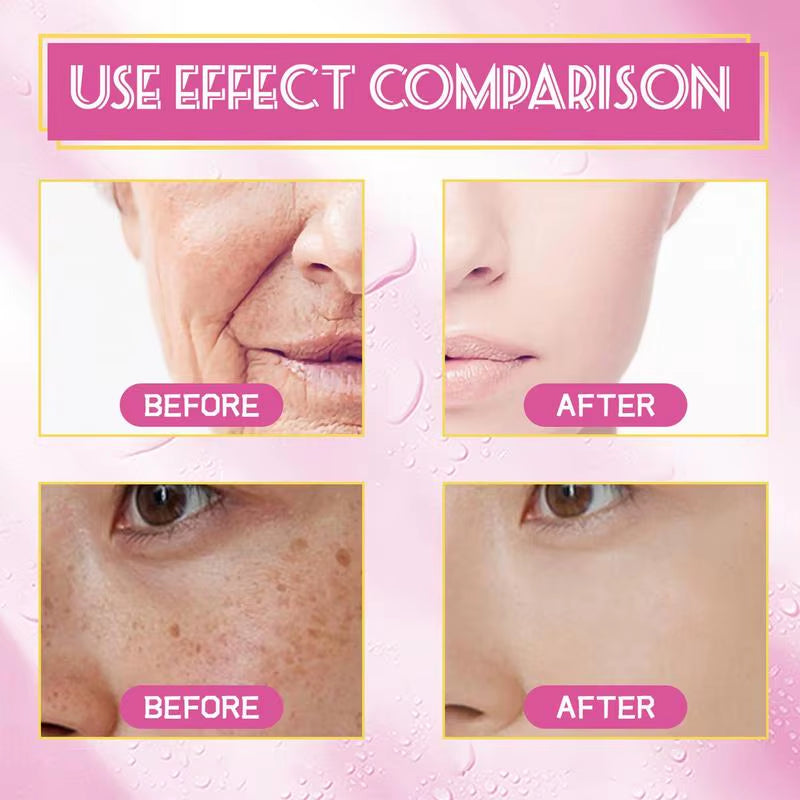 Rosehip Oil 30Ml Natural Ordinary Rosehip Oil for Face Firming Facial Skin Care Serums Moisturizer Face Oil Beauty and Health